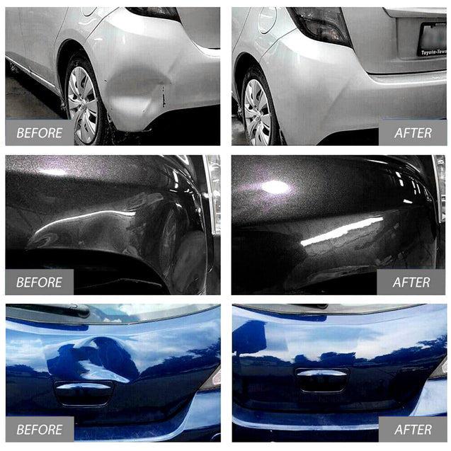 Car Paintless Dent Puller Tabs Bridge Lifter Body Repair Hail Removal Tool Kit